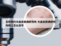 怎样预约大连皮肤病研究所 大连皮肤病研究所网上怎么挂号