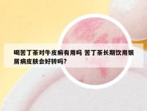 喝苦丁茶对牛皮癣有用吗 苦丁茶长期饮用银屑病皮肤会好转吗?