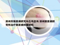 郑州市银屑病研究所在线咨询 郑州银屑病研究所治疗银屑病效果好吗
