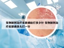 生物制剂治疗皮肤病给打多少针 生物制剂治疗皮肤病多久打一针