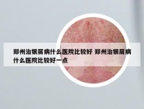 郑州治银屑病什么医院比较好 郑州治银屑病什么医院比较好一点