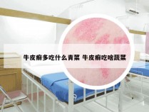 牛皮癣多吃什么青菜 牛皮癣吃啥蔬菜
