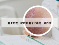 肚上出现一块白斑 肚子上出现一块白斑