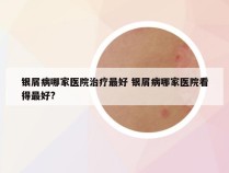 银屑病哪家医院治疗最好 银屑病哪家医院看得最好?