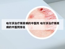 哈尔滨治疗银屑病的中医院 哈尔滨治疗银屑病的中医院排名