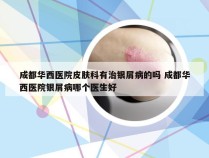 成都华西医院皮肤科有治银屑病的吗 成都华西医院银屑病哪个医生好
