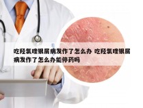 吃羟氯喹银屑病发作了怎么办 吃羟氯喹银屑病发作了怎么办能停药吗