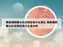 银屑病初期小红点按压有什么变化 银屑病初期小红点按压有什么变化吗