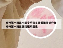 郑州第一附属中医学院张小静看银屑病咋样 郑州第一附属医院张晓医生
