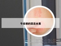 牛皮癣的禁忌水果