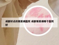 成都好点的银屑病医院 成都银屑病哪个医院好