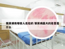 银屑病有哪些人危险的 银屑病最大的危害是什么