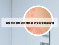 浓复方苯甲酸软膏银屑病 浓复方苯甲酸涂剂