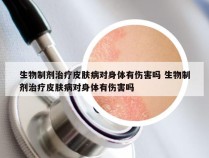 生物制剂治疗皮肤病对身体有伤害吗 生物制剂治疗皮肤病对身体有伤害吗