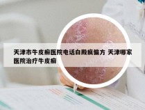 天津市牛皮癣医院电话白殿疯偏方 天津哪家医院治疗牛皮癣