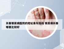 长春银屑病医院的地址乘车路线 银屑病长春哪里比较好
