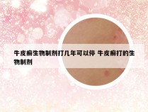 牛皮癣生物制剂打几年可以停 牛皮癣打的生物制剂