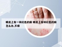 眼皮上有一块红色的癣 眼皮上有块红色的癣怎么办,不痒
