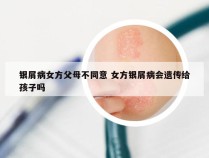 银屑病女方父母不同意 女方银屑病会遗传给孩子吗