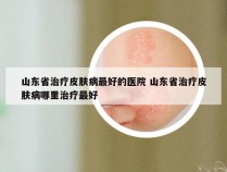山东省治疗皮肤病最好的医院 山东省治疗皮肤病哪里治疗最好