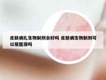 皮肤病扎生物制剂会好吗 皮肤病生物制剂可以报医保吗