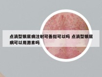 点滴型银屑病注射可善挺可以吗 点滴型银屑病可以用激素吗