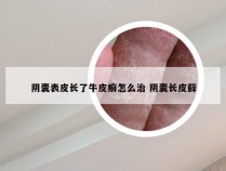 阴囊表皮长了牛皮癣怎么治 阴囊长皮藓