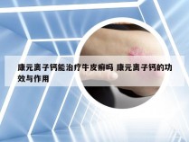 康元离子钙能治疗牛皮癣吗 康元离子钙的功效与作用