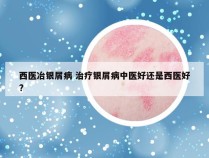 西医冶银屑病 治疗银屑病中医好还是西医好?