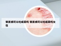 银屑病可以吃咸菜吗 银屑病可以吃咸菜吗女性