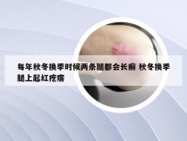 每年秋冬换季时候两条腿都会长癣 秋冬换季腿上起红疙瘩