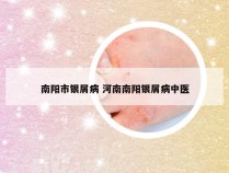南阳市银屑病 河南南阳银屑病中医