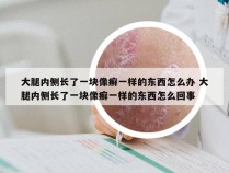 大腿内侧长了一块像癣一样的东西怎么办 大腿内侧长了一块像癣一样的东西怎么回事