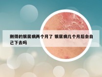 刚得的银屑病两个月了 银屑病几个月后会自己下去吗