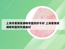 上海市看银屑病哪家医院好不好 上海看银屑病哪家医院效果最好