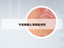 牛皮癣病人海带能吃吗