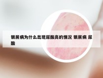 银屑病为什么出现尿酸高的情况 银屑病 尿酸
