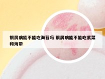 银屑病能不能吃海苔吗 银屑病能不能吃紫菜和海带