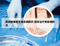 新闻联播国家银屑病新药 国家治疗银屑病新药