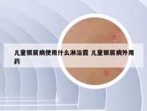 儿童银屑病使用什么淋浴露 儿童银屑病外用药