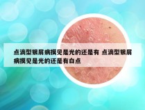 点滴型银屑病摸见是光的还是有 点滴型银屑病摸见是光的还是有白点