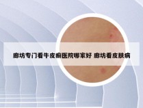 廊坊专门看牛皮癣医院哪家好 廊坊看皮肤病