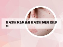 复方凉血散治银屑病 复方凉血散在哪里能买到