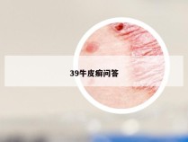 39牛皮癣问答