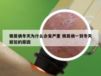 银屑病冬天为什么会变严重 银屑病一到冬天就犯的原因