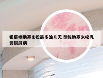 银屑病地塞米松最多涂几天 醋酸地塞米松乳膏银屑病