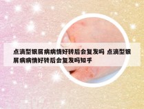 点滴型银屑病病情好转后会复发吗 点滴型银屑病病情好转后会复发吗知乎