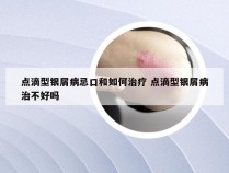 点滴型银屑病忌口和如何治疗 点滴型银屑病治不好吗