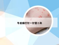 牛皮癣打针一针管二年