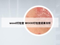 wood灯检查 WOOD灯检查结果分析